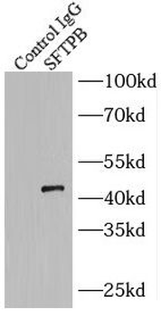 SFTPB Antibody