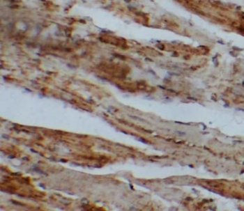 SFTPB Antibody