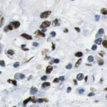 SFXN3 Antibody
