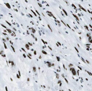 SGK3 Antibody