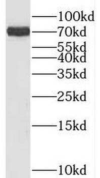 SLC5A2 Rabbit Polyclonal Antibody