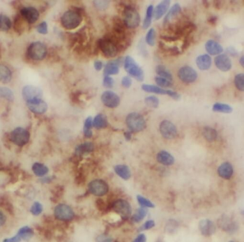 SGMS1 Antibody
