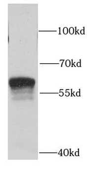 SGSH Antibody