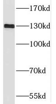 SGSM1 Antibody