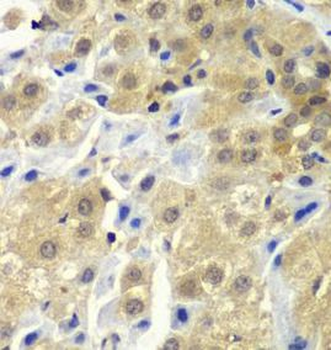 SGTA Antibody