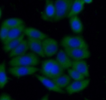 SH2B1 Antibody