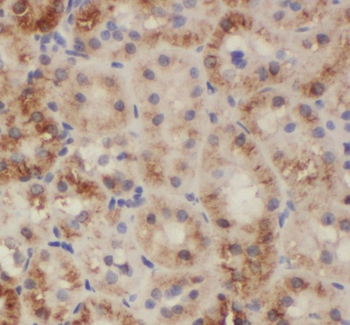 SH2D1B Antibody