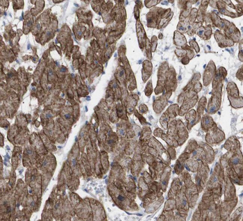 SH2D2A Antibody