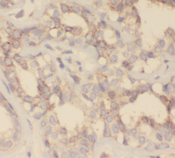 SH2D3C Antibody
