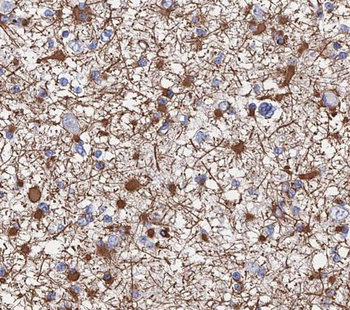 SH3GL2 Antibody