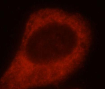 SH3PXD2A Antibody