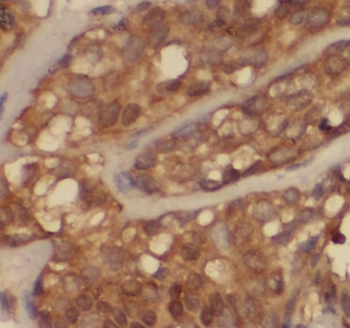 SH3PXD2A Antibody
