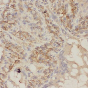 SHARPIN Antibody