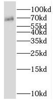 SHC1 Rabbit Polyclonal Antibody