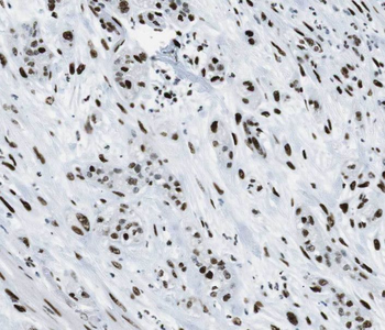 SHC1 Rabbit Polyclonal Antibody