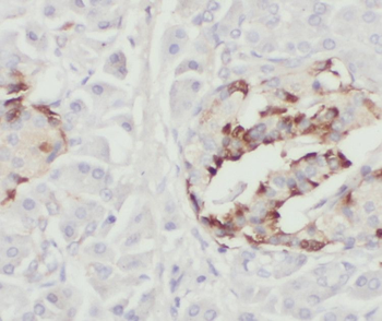 SHC3 Antibody