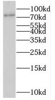 SHKBP1 Antibody