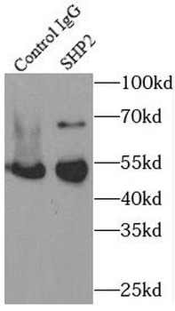 PTPN11 Antibody
