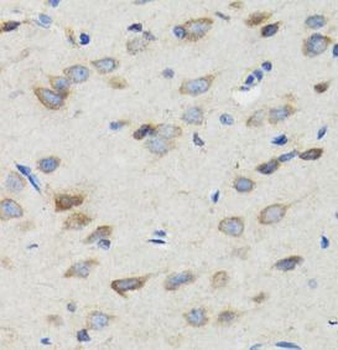 SIAH1 Antibody