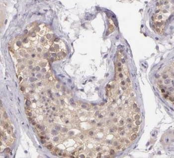 SIK1 Antibody