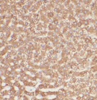 SIKE1 Antibody