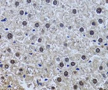 SIN3A Rabbit Polyclonal Antibody
