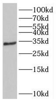 GEMIN2 Antibody