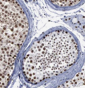 SIRT1 Antibody