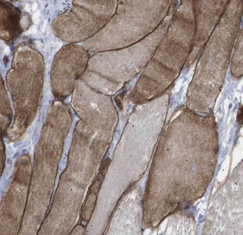 SIRT4 Antibody