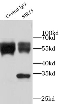 SIRT5 Antibody