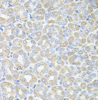 SKAP2 Antibody
