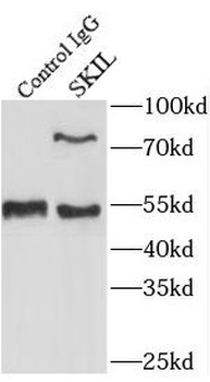 SKIL Rabbit Polyclonal Antibody