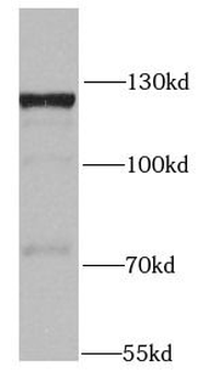 MTREX Antibody