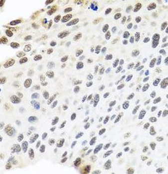 MTREX Antibody