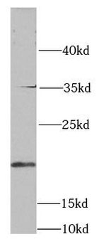 SKP1 Antibody