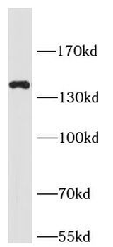 SLC12A2 Antibody