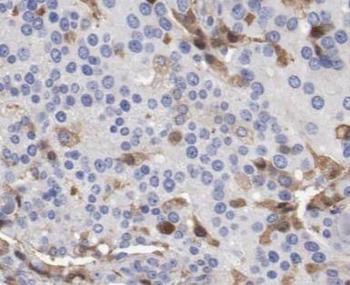 SLC16A3 Antibody