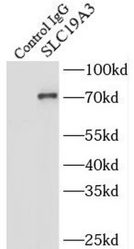 SLC19A3 Antibody