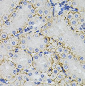 SLC1A4 Antibody