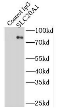 SLC20A1 Antibody