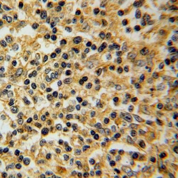 SLC20A1 Antibody