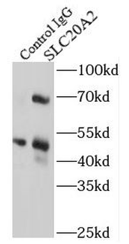 SLC20A2 Antibody