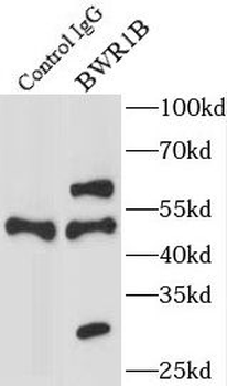 SLC22A18AS Antibody