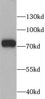 SLC25A13 Rabbit Polyclonal Antibody