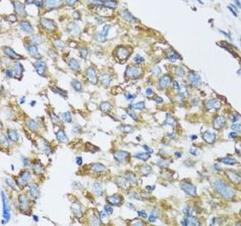 SLC25A13 Antibody