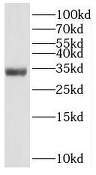 SLC25A2 Antibody