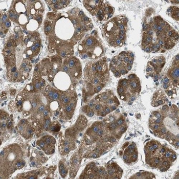 SLC25A2 Antibody