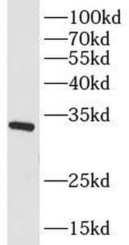 SLC25A20 Antibody