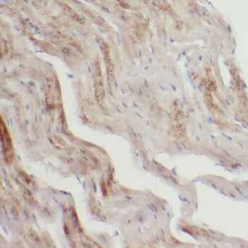 SLC25A20 Antibody