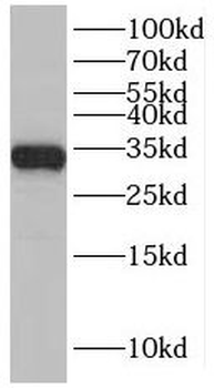 SLC25A22 Rabbit Polyclonal Antibody